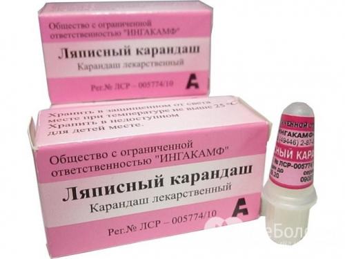 Что такое ляписный карандаш и для чего он нужен. Ляписный карандаш от папиллом