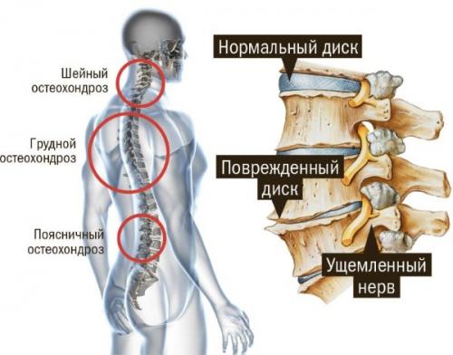 Какие пищевые продукты можно получить из бишофита. Использование препарата в домашних условиях