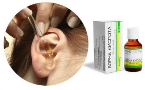 Как часто нужно применять борный спирт в ухо для профилактики инфекций. Что такое борный спирт